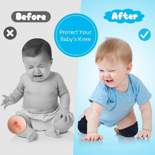 Baby Knee Pads for Crawling, Anti-Slip Stretchable Knee & Elbow Protectors, Multicolour, Pack of 2 Pairs